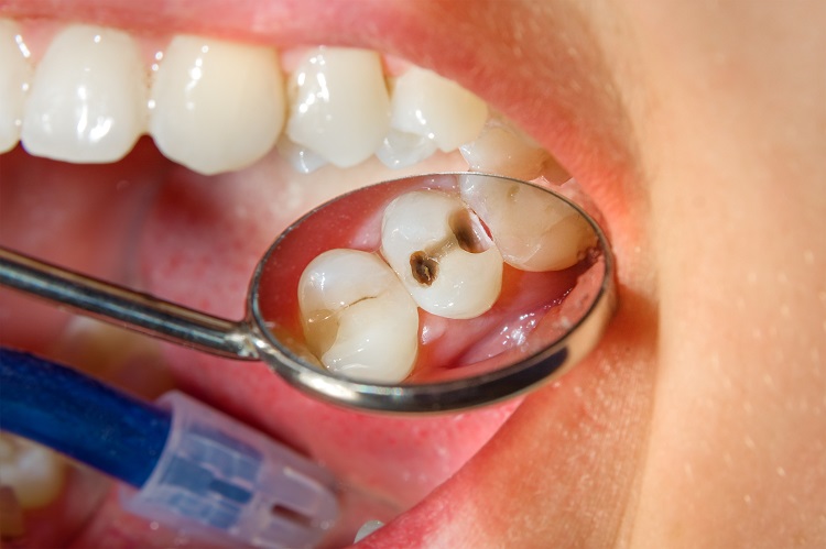 COMMON DENTAL PROBLEMS AND THEIR TREATMENT